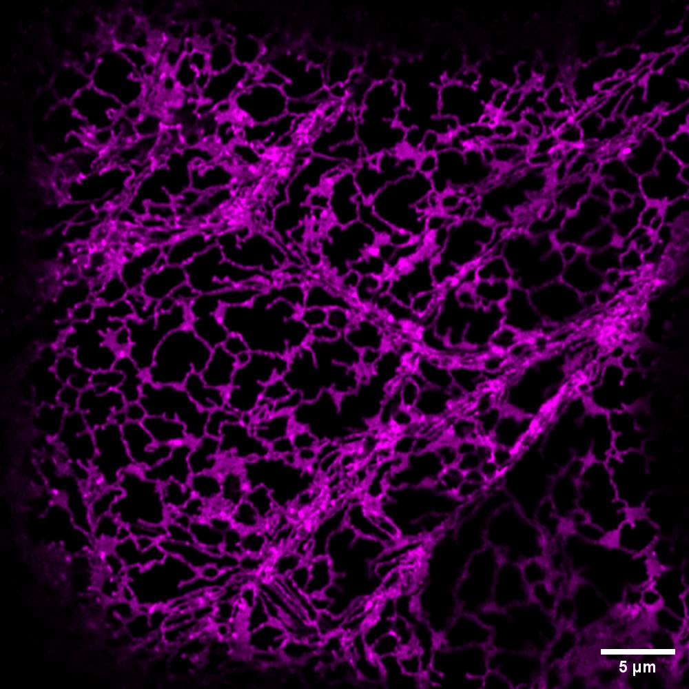 Fluorescence microscopy shows the endoplasmic reticulum inside the epidermal cells of Nicotiana benthamiana leaf tissue. Image credit: Olivia Walk.