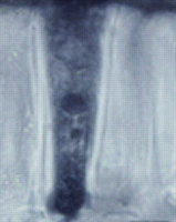Hourglass cell development in soybean seed coat