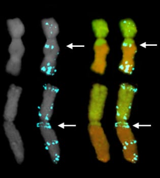 Translocation breakpoints in SSR-rich chromosomal regions Translocation breakpoints in SSR-rich chromosomal regions