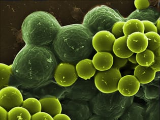 Oxidative stress responses in two lichen phycobionts