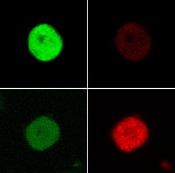 Chloroplast to chromoplast transition in tomato fruit Chloroplast to chromoplast transition in tomato fruit