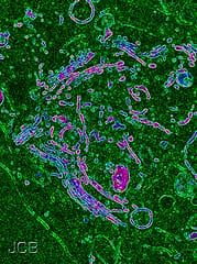 Tales of tethers and tentacles: golgins in plants