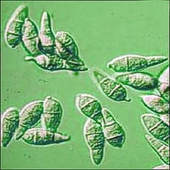 The Top 10 fungal pathogens in molecular plant pathology