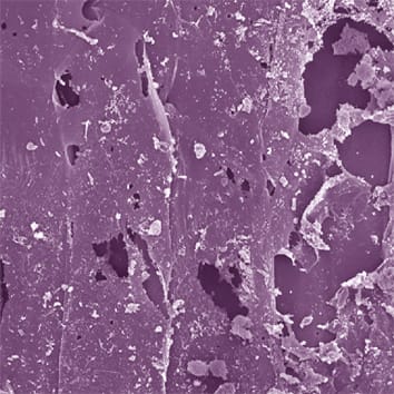 Uptake of toxic metals by rice