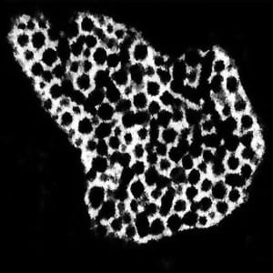 Announcing a brand new cellular organelle – the tannosome