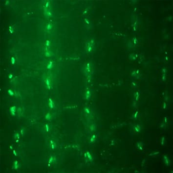 Morphogenesis and contact sites in lobed mesophyll cells