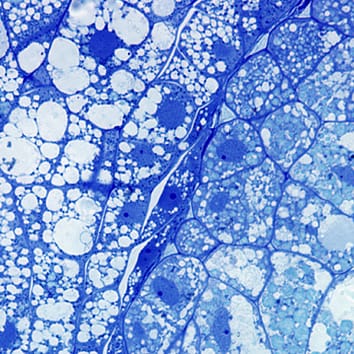 Novel structure of placenta in a lycophyte