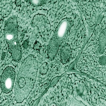 Intracellular ice and cell survival in seeds of Acer