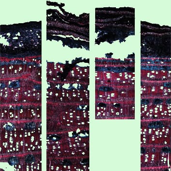 Patchy radial increment in the mangrove Avicennia
