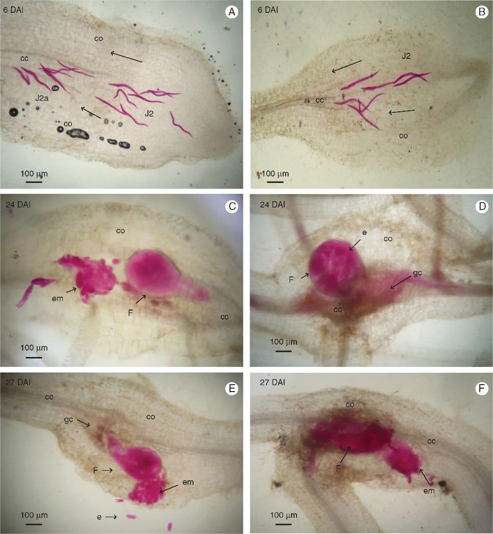Gene expression in Musa acuminata during interactions with Meloidogyne incognita