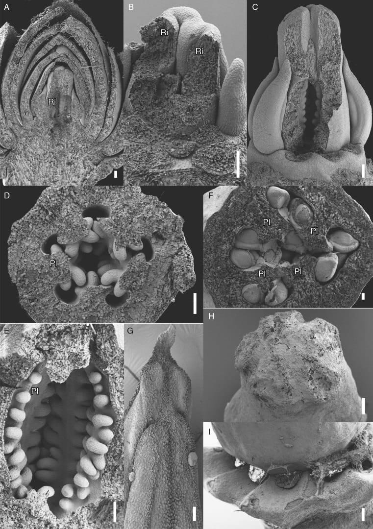 Berberidopsis beckleri, floral development and evolution of the core eudicots
