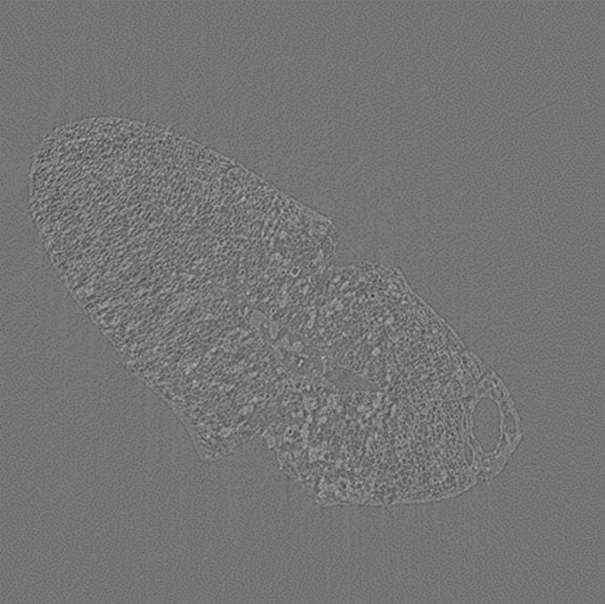 This is a slice through image of horsegram seed.
