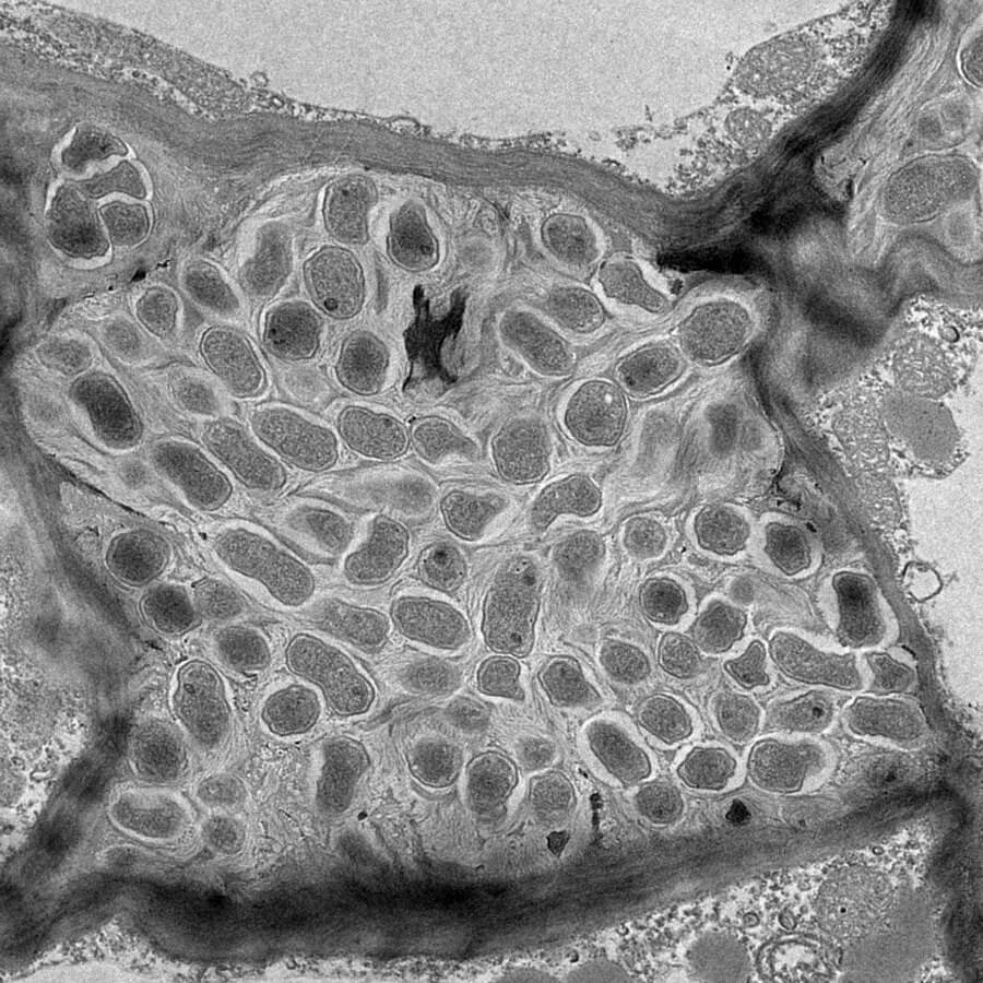 Effects of plant polyploidy on the legume-rhizobia mutualism