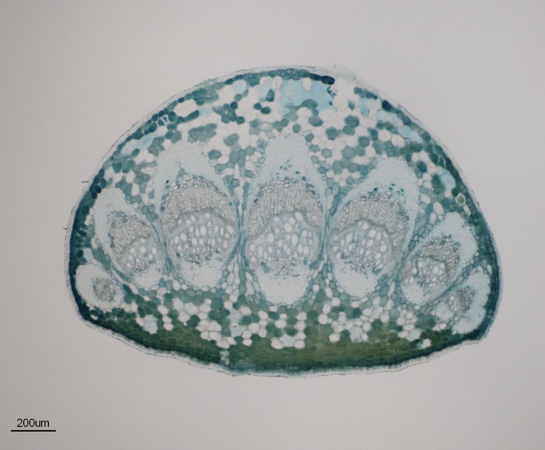 Links between leaf venation and xylem anatomy to leaf hydraulic vulnerability