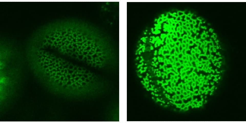 Exine patterning on the pollen.