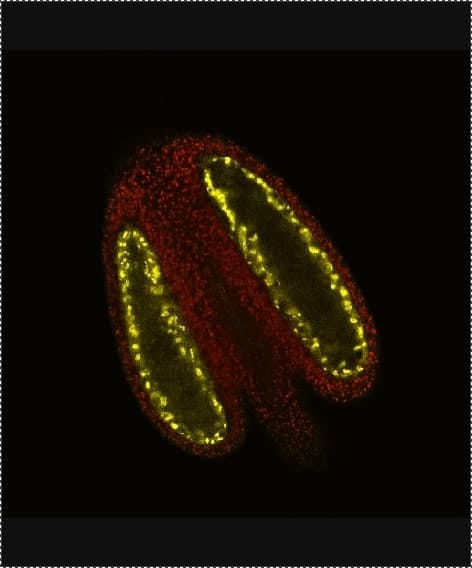 Aborted microspore protein