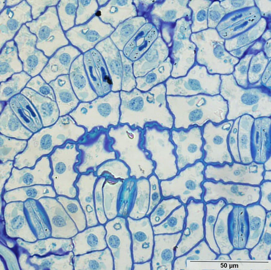 Epidermal patterning and stomatal development in Gnetales