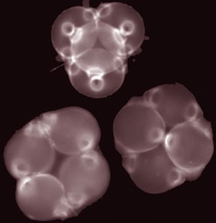 Tetrad shape and aperture pattern ontogeny in pollen