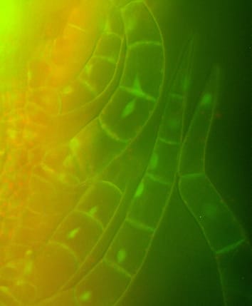 Cellular expression of GFP in transgenic potato cells