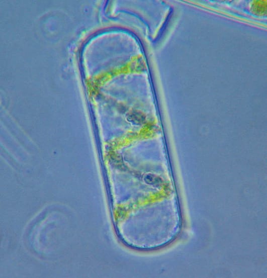 An algal cell with single helical chloroplast Image: Jasper Nance/Wikimedia Commons.