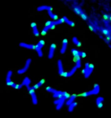 Satellite DNA family in Medicago and allied genera