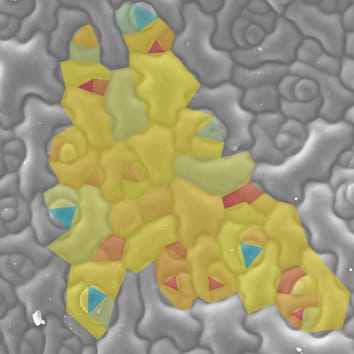 Heterogeneous growth of Arabidopsis leaf epidermis