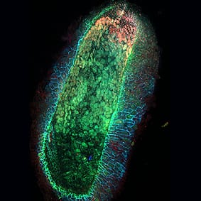 Characterizing sub-optimal clover nodule phenotypes