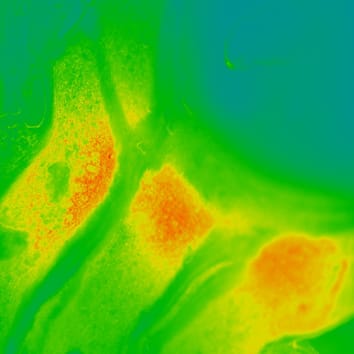 Causes of low pressures at phloem termini