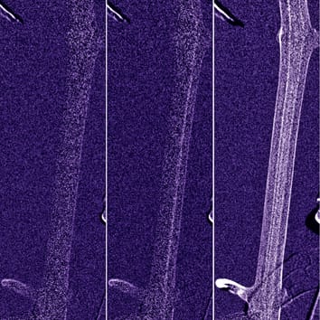 Visualization of embolism formation using cold neutron radiography