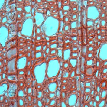 Functional differentiation of axial and radial parenchyma