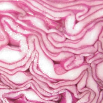 Selenium toxicity in plants (Botanical Briefing)