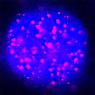 The tannosome: a new chloroplast-derived organelle