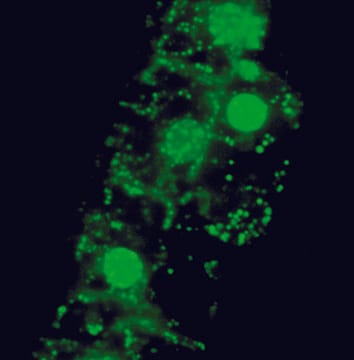 Live cell imaging reveals extensive intracellular cytoplasmic colonization of banana by normally non-cultivable endophytic bacteria