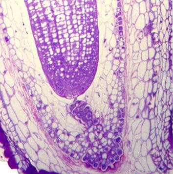 Ricinosomes and cell death in suspensor and endosperm cells