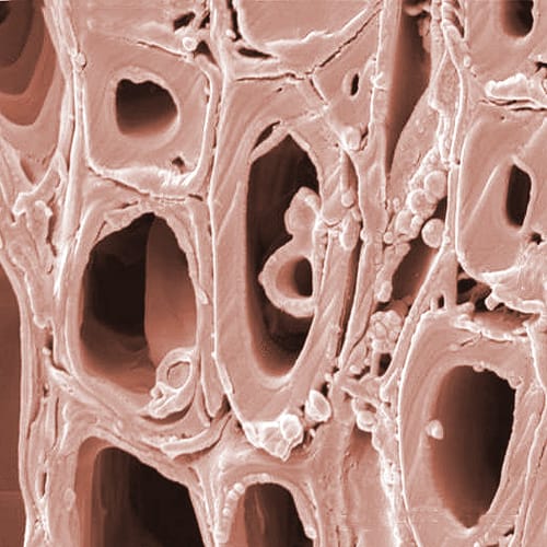 Mechanism of resistance to Dutch elm disease, MADS goes genomic in conifers and floral symmetry and pollination – This Week in Annals of Botany