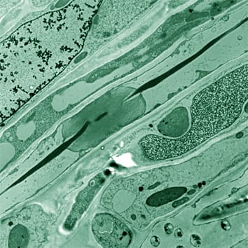 Molecular analysis and evolution of forisomes