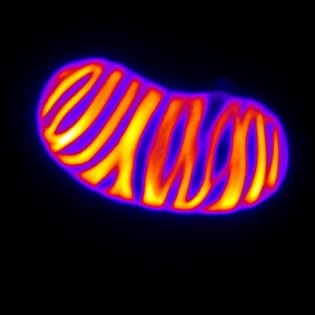 Cell biology of lignification in higher plants (Review)