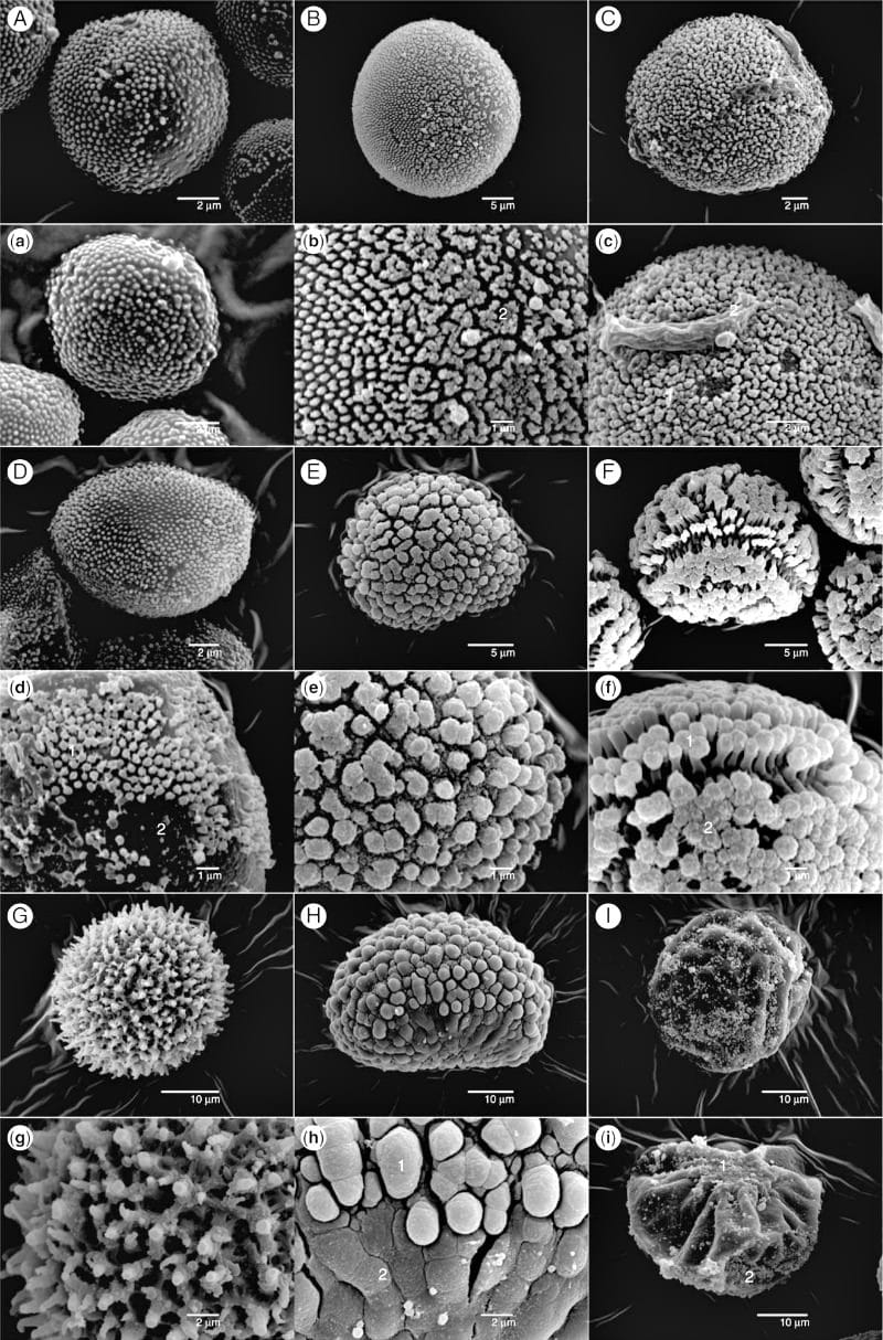 Scanning electron microscope photographs of the investigated moss spores.