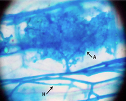 Impact of an invasive nitrogen-fixing tree on arbuscular mycorrhizal fungi and development of native species