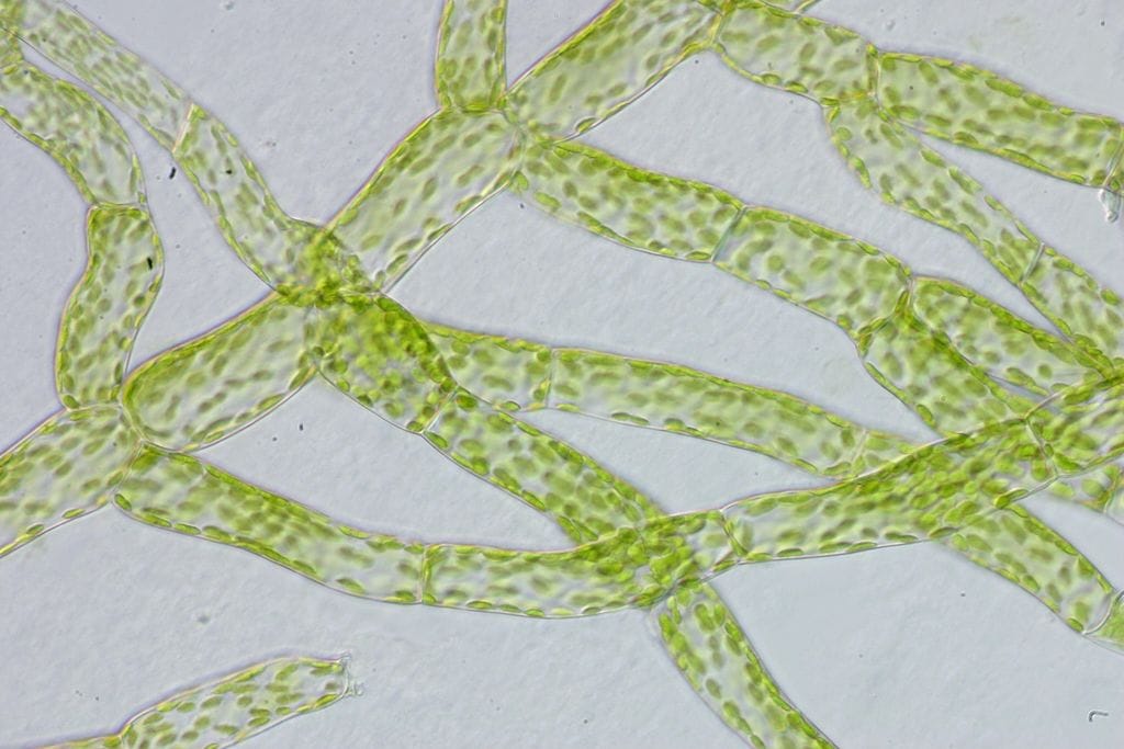 Protonemacells of Physcomitrella patens
