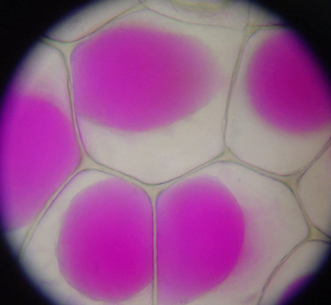 Epidermis cells of Rhoeo Discolor (Tradescantia) after plasmolysis.