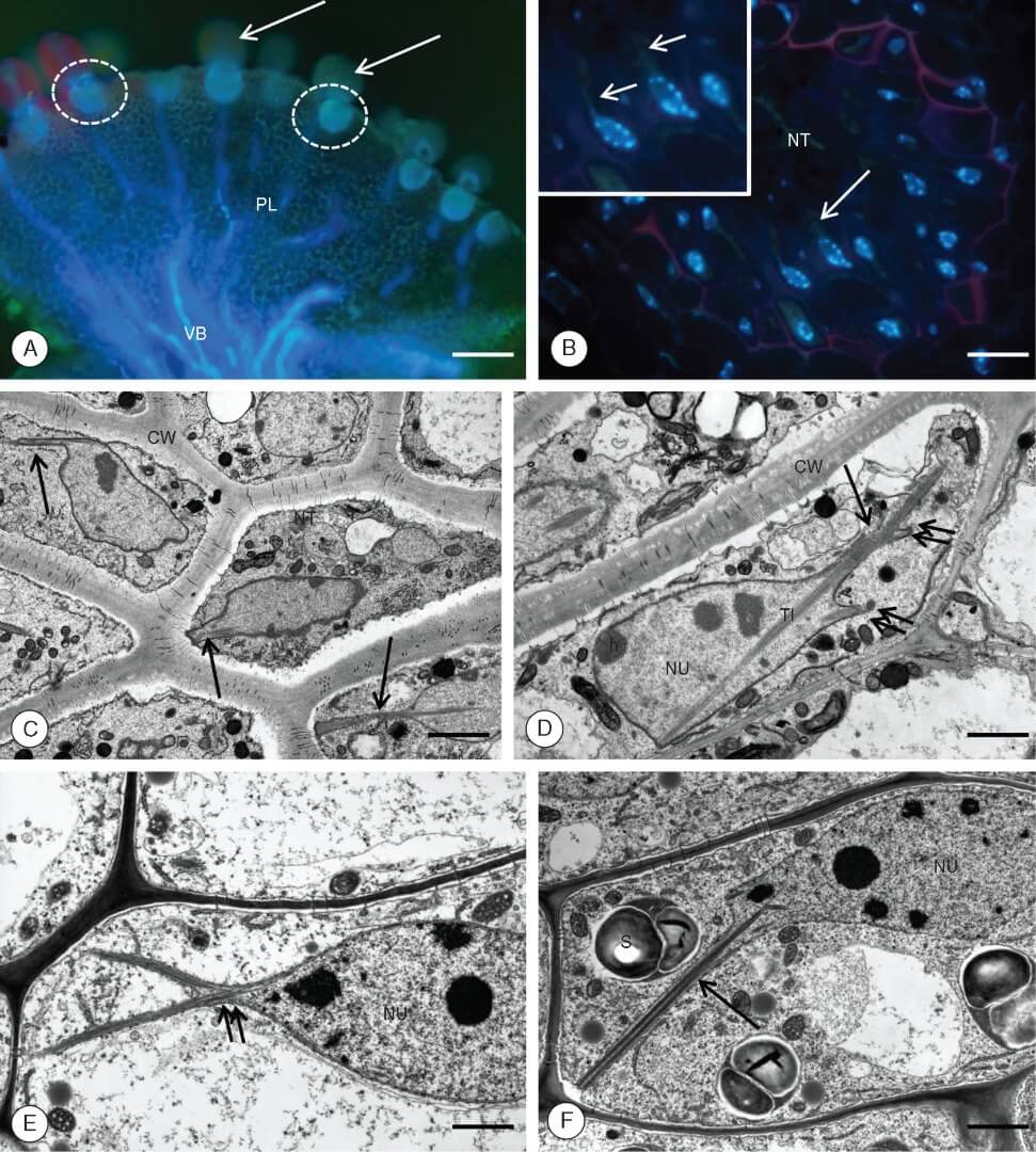 Utricularia nelumbifolia. The localization and general structure of the placental nutritive tissue.