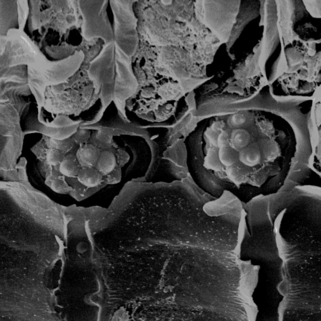 SEM image of Butia capitate