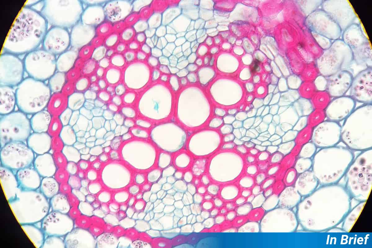 Xylem